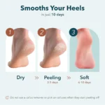 Purederm, Exfoliating Foot Mask, Large, 1 Pair - Image 2