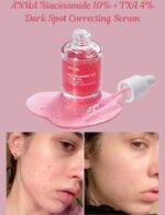 Anua Niacinamide 10% + TXA 4% Serum 30 ml - Image 3